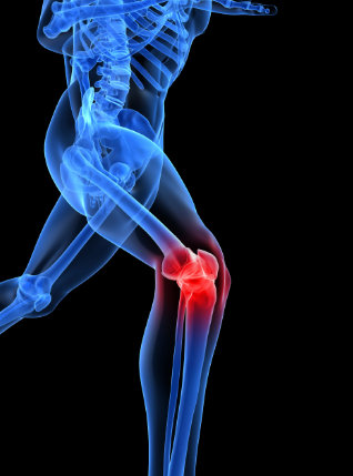 runner's knee injury
