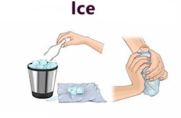 Ice in the RICE method for muscle pain