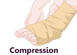 Muscle compression in the RICE technique