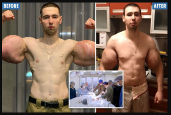 Kirill Tereshin is the Russian Synthol Man