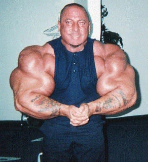 Greg Valentino's arms explode due to Synthol