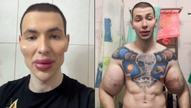 Current appearance of the Russian Synthol man